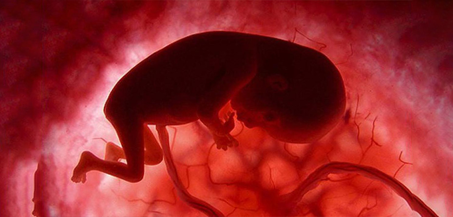 استرس، عاملی تعیین کننده در فرآیند درمان نازایی