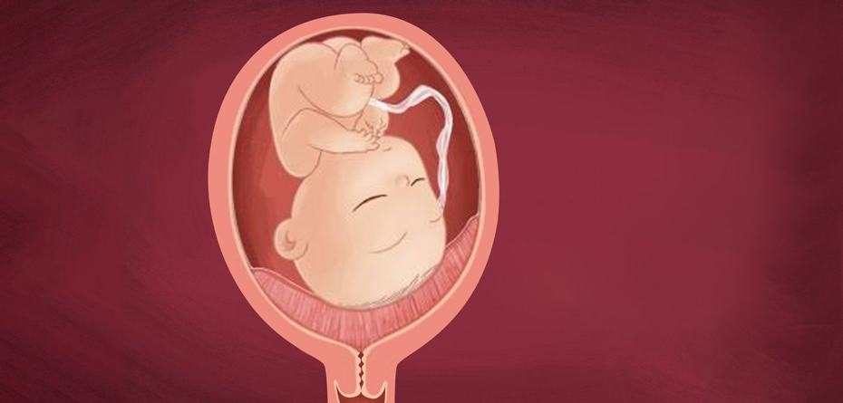 جفت سر راهی چیست؟