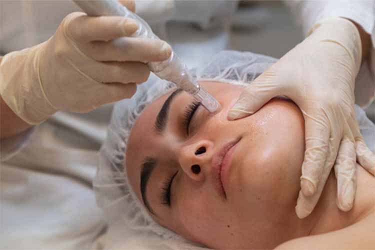 میکرونیدلینگ صورت چیست؟کاربردها,مزایا,عوارض,قیمت